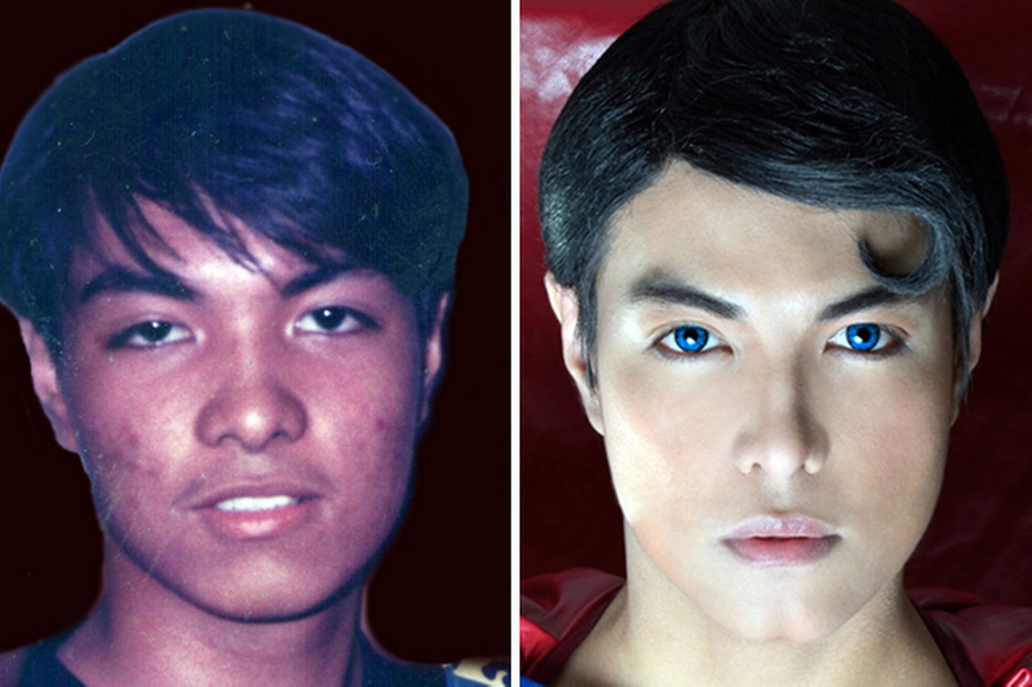 мужская пластика фото до и после